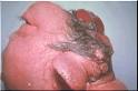Neuropathology Mini-Course For Residents