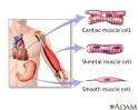 Types of muscle tissue: MedlinePlus Medical Encyclopedia Image
