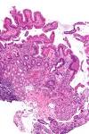 <b>metaplasia</b> - intermed mag.