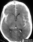 Welcome to LearningRadiology