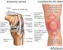 Dolor de <b>rodilla</b>: