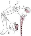 arthroplasty - definition of arthroplasty in the Medical ...