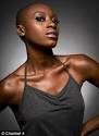 Big Brother's Bald Girl