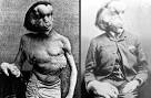 Elephant Man