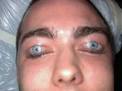 Weird Eyelid Tattoo: Are my eyes shut, no seriously? on Weird Things