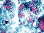 of <b>Mycobacterium leprae</b>