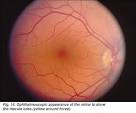 the <b>retina</b> to show macula