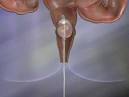 Insufflation Medicine