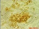<b>Aspergillus oryzae</b>