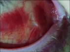 <b>eye injuries</b> ranging from:
