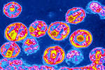140710-hiv-virus-1637_9a2ebb.