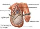 Prostatitis: Epididymis