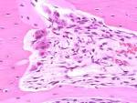 <b>Osteoclasts</b>