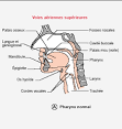 <b>Syndrome d</b>'<b>Apnées Obstructives</b>