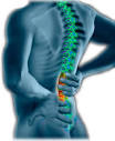 St. Louis <b>Back Injury</b> Lawyer