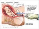 Abortion Methods | Pregnancy Stages , Details &amp; Problems