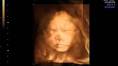 Anna - 30 Semanas - (Será