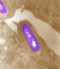 500 succumb to <b>infection</b>.