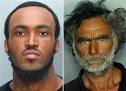 Face-chewing victim face surgery, long recovery