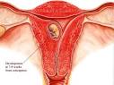 Difference between implantation bleeding period