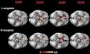 Gay men and heterosexual women have similarly shaped brains ...