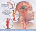 Mayo Clinic medical information and tools for healthy living ...