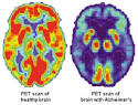 <b>Memory Disorders</b> - The Human <b>Memory</b>
