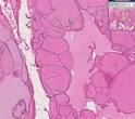 Thyroid Histology