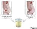 Urine sample: MedlinePlus Medical Encyclopedia Image