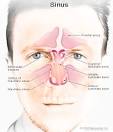 Sinus Headache Causes, Symptoms, and Treatment by MedicineNet.