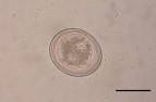 File:A <b>toxascaris</b> leonina1.JPG