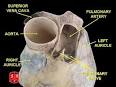 Atrium (heart) - Wikipedia, the free encyclopedia