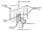 of <b>anterior horn cells</b> at
