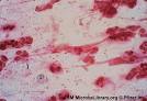 MicrobeLibrary - Sputum Gram-Negative Diplococci and Coccobacilli