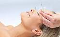 Acupuncture And Anxiety photos