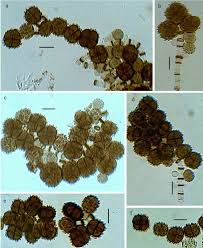Résultat de recherche d'images pour "Dictyoarthrinium lilliputeum"