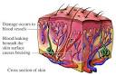 more severe <b>contusions</b> may