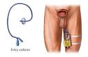 Urinary Catheter Care