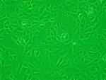 File:<b>Vero cells</b>.jpg