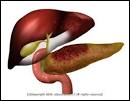 Acute Pancreatitis – Symptoms, Causes and Treatment