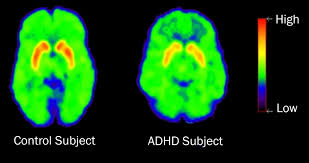 Not Correlated with ADHD