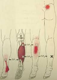 Soleus
