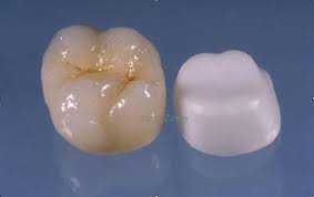 pictures tooth crown
