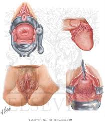 Sexually Transmitted Diseases
