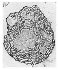 celula plasmatica