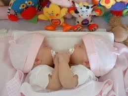 conjoined twins,