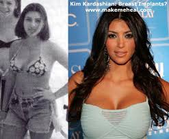 Kim Kardashian fotos