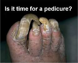 pedicure