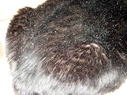 dandruff