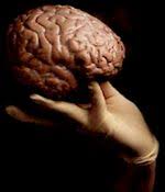 http://t3.gstatic.com/images?q=tbn:MCkLZn7A5Wah6M%3Ahttp://www.chu-brugmann.be/images/med/neuro.jpg